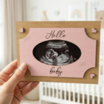 Baby-Scan-Ultrasound-Frames-Laser-Bundle-Laser-Cutting-139697360-15-580x387